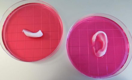 Gotowe do przeszczepu wydruki: fragment żuchwy i ucho