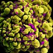 Tak wyglądają pod mikroskopem wirusy HIV atakujące komórkę układu odpornościowego