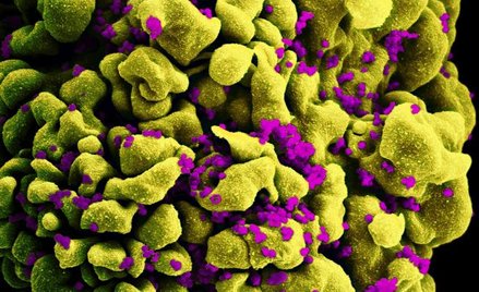 Tak wyglądają pod mikroskopem wirusy HIV atakujące komórkę układu odpornościowego