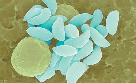 Toxoplasmę gondii przenoszą m.in. koty