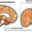 Zbitka szarych komórek położona na wysokości gałek ocznych w dużym stopniu może zawiadywać naszą świ