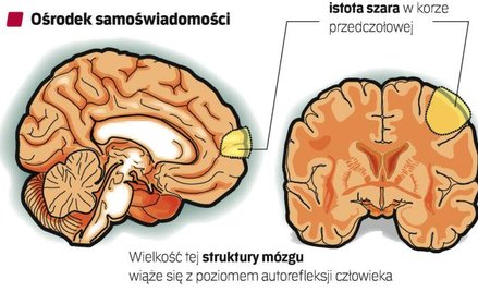 Zbitka szarych komórek położona na wysokości gałek ocznych w dużym stopniu może zawiadywać naszą świ