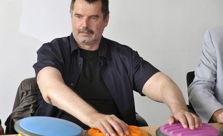 Karl Merk, któremu przeszczepiono ręce, nie żałuje decyzji o przeszczepie