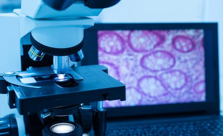 Analitycy: Przecena spółek biotechnologicznych okazją do zakupów