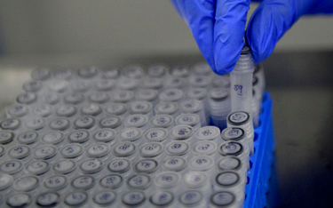 Scope Fluidics chce wejść na rynek USA z badaniami na koronawirusa