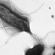 Helicobacter pylori w mikroskopie elektronowym