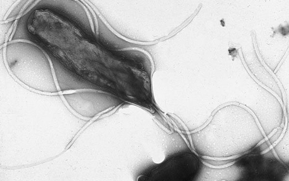 Helicobacter pylori w mikroskopie elektronowym