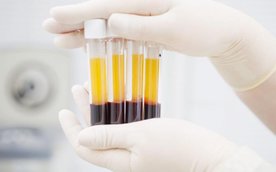 Apel o krew dla policjantki