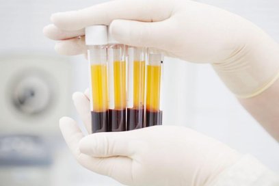 Apel o krew dla policjantki