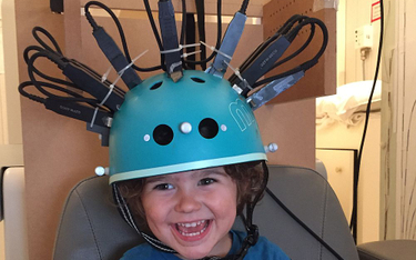 Przerobiony kask rowerowy przeanalizuje mózg dziecka