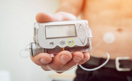 Ulga rehabilitacyjna: czy przedsiębiorca odliczy pompę insulinową?