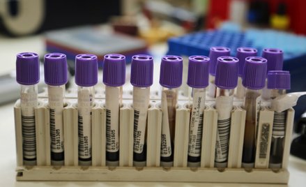 Liczba ofiar Covid-19 w Polsce przekroczyła tysiąc