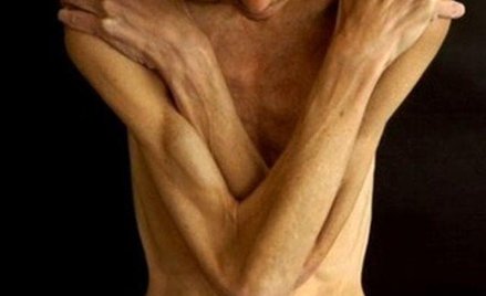 Zapomniany problem: niedowaga