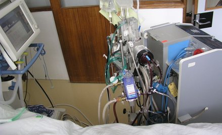 Koronawirus. Czy wiek chorych na COVID w ciężkim stanie spada? Dyrektor szpitala odpowiada