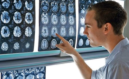 Badania mózgu należą do najbardziej skomplikowanych we współczesnej medycynie