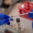 Jak podkreślają eksperci, głównym źródłem problemu antybiotykooporności pozostaje nadużywanie i niew