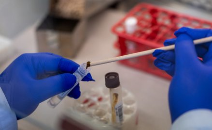 Jak podkreślają eksperci, głównym źródłem problemu antybiotykooporności pozostaje nadużywanie i niew