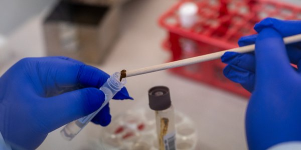 Zmiany klimatu karmią groźną bakterię. Ma coraz lepsze warunki do rozwoju