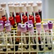 Pacjenci czekają na refundacje preparatów immunoglobin