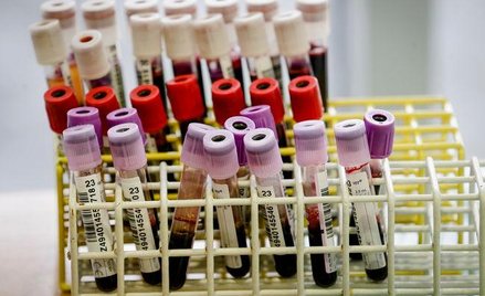 Pacjenci czekają na refundacje preparatów immunoglobin