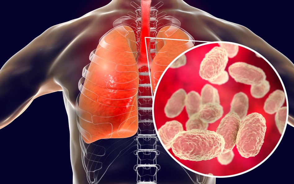 W Polsce rośnie liczba zachorowań na krztusiec. To ostra choroba zakaźna dróg oddechowych, którą wyw