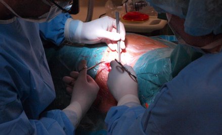 Proces o błędy lekarskie w czasie powiększania piersi