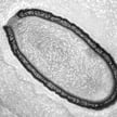 Wirus Pithovirus sibericum jest gigantyczny i ma kilkaset genów