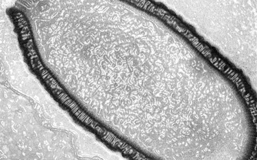 Wirus Pithovirus sibericum jest gigantyczny i ma kilkaset genów