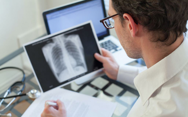 Brak kompleksowej opieki dla chorych z rakiem płuca