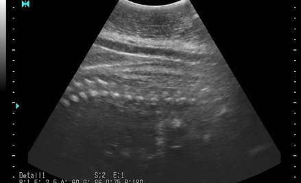 Pierwsze zdjęcia foczego malucha