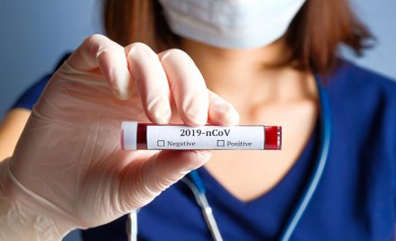 Koronawirus: testów nie zabraknie, nie ma kolejek do badań – twierdzi resort zdrowia