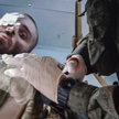 Ranny ukraiński żołnierz przed wywiezieniem z Mariupola. Zdjęcie jest kadrem z filmu rosyjskiego Min