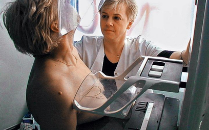 Badania profilaktyczne, mammografia zwiększają szanse na pokonanie choroby