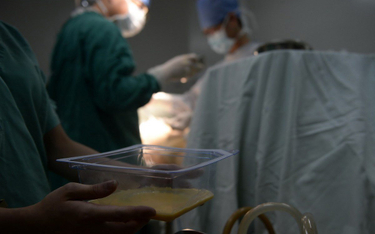 Francja: Będą odszkodowania za wadliwe implanty piersi