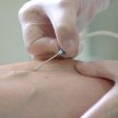 Szpitale nie traktują zakłuć pielęgniarek ostrymi narzędziami jako wypadku przy pracy co prowadzi do