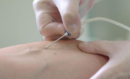 Szpitale nie traktują zakłuć pielęgniarek ostrymi narzędziami jako wypadku przy pracy co prowadzi do