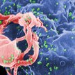 Wirusy HIV atakujące limfocyty / CDC, Wikipedia