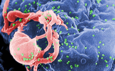 Wirusy HIV atakujące limfocyty / CDC, Wikipedia