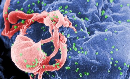 Wirusy HIV atakujące limfocyty / CDC, Wikipedia
