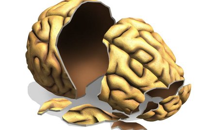 Nowy sposób na alzheimera