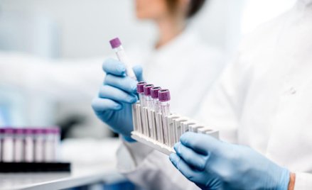 PBKM: więcej próbek w III kw.