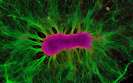 Fot: Collin Edington, Iris Lee. Komórki macierzyste mają zdolność do tworzenia wszystkich typów różn