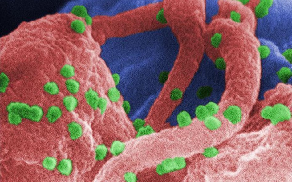 Wirusy HIV (zielone) atakujące komórki człowieka widoczne pod mikroskopem elektronowym. Naukowcy sąd