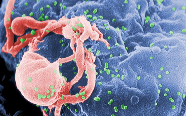 Wirus HIV atakujący komórkę w ciele człowieka.