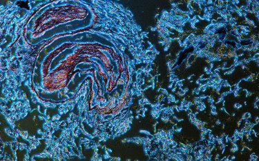 Wykonane pod mikroskopem zdjęcia komórek trzustkowych tworzą niemal kosmiczną harmonię barw i kształ