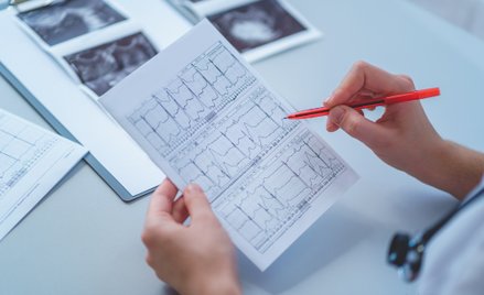 Informacje Medicalgorithmics uskrzydliły inwestorów. Uzasadniony entuzjazm?