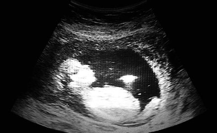 Nie zagłuszać sumienia