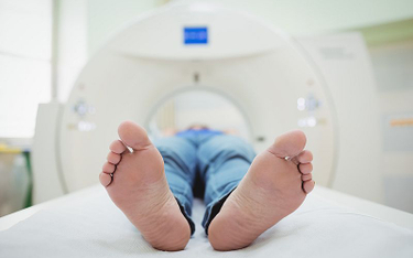 Onkolodzy: potrzeba wytycznych do opisywania rezonansu i tomografii komputerowych