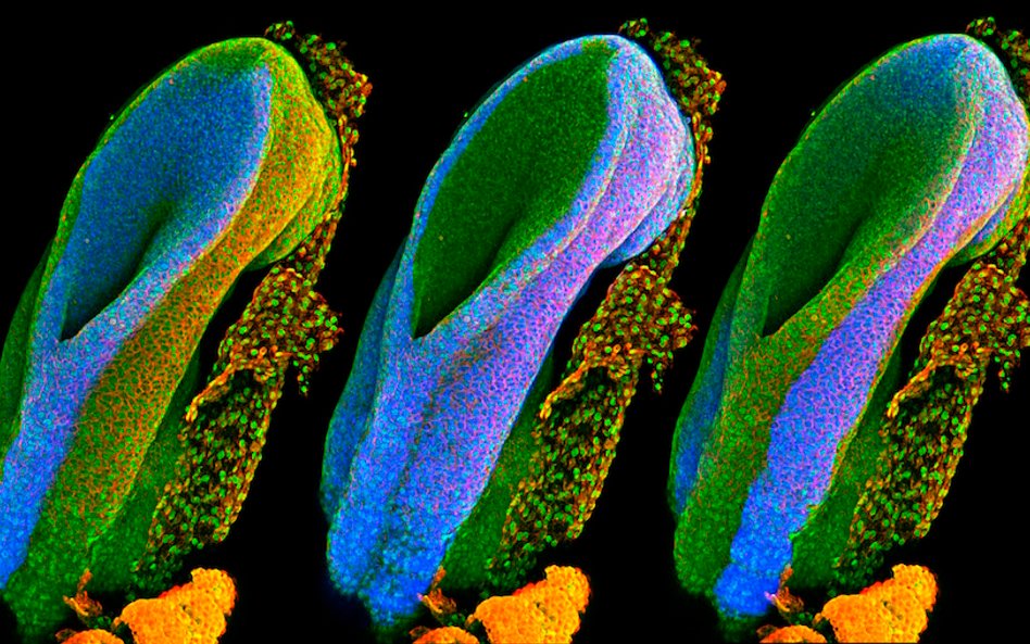 Fot: Gabriel Galea. Zdjęcie pokazuje rozwijający się rdzeń kręgowy