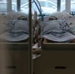 Nowa analiza: Prawdopodobieństwo hospitalizacji o 50-70 proc. mniejsze w przypadku Omikrona niż Delt